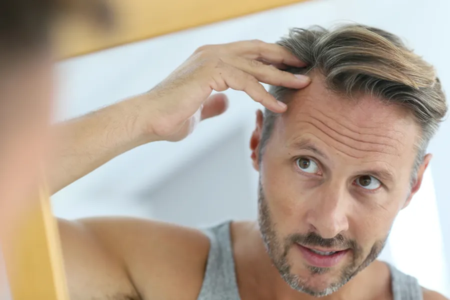 Hair-Restoration-Clinic A middle-aged man looks in the mirror, worried about his hairline. Schedule hair restoration treatments from Jennifer Jose-Cappola, MD in Stamford.