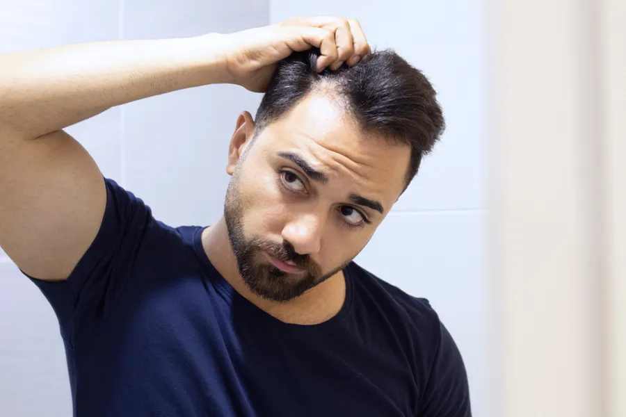 PRP-for-Hair-Loss-Doctor A man in a navy t-shirt looks in the mirror worrying about and touching his receding hairline, considering PRP for hair loss and restoration treatment from Jennifer Jose-Cappola, MD in Stamford.